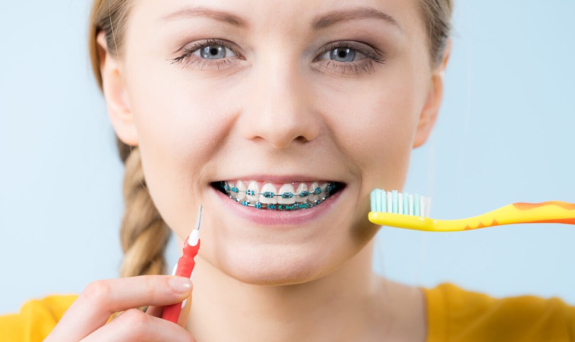 Proper oral hygiene when wearing braces Hình: Proper oral hygiene when wearing braces