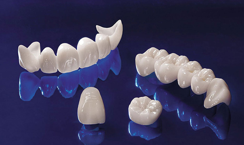 Cercon Art: A New CAD/CAM System for Esthetic All-Ceramics Hình: Cercon Art: A New CAD/CAM System for Esthetic All-Ceramics