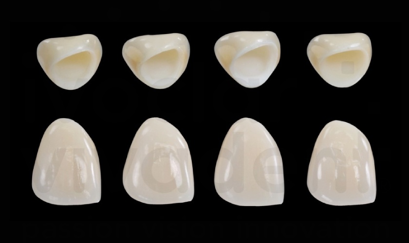 IPS E.MAX Porcelain Hình: IPS E.MAX Porcelain